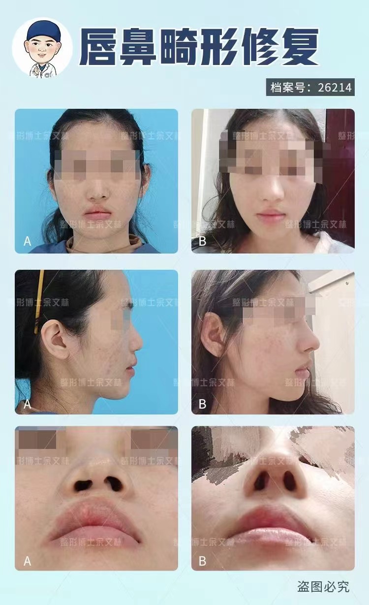 有哪些成功實(shí)例可以證明劉彥軍 醫(yī)生的實(shí)力？