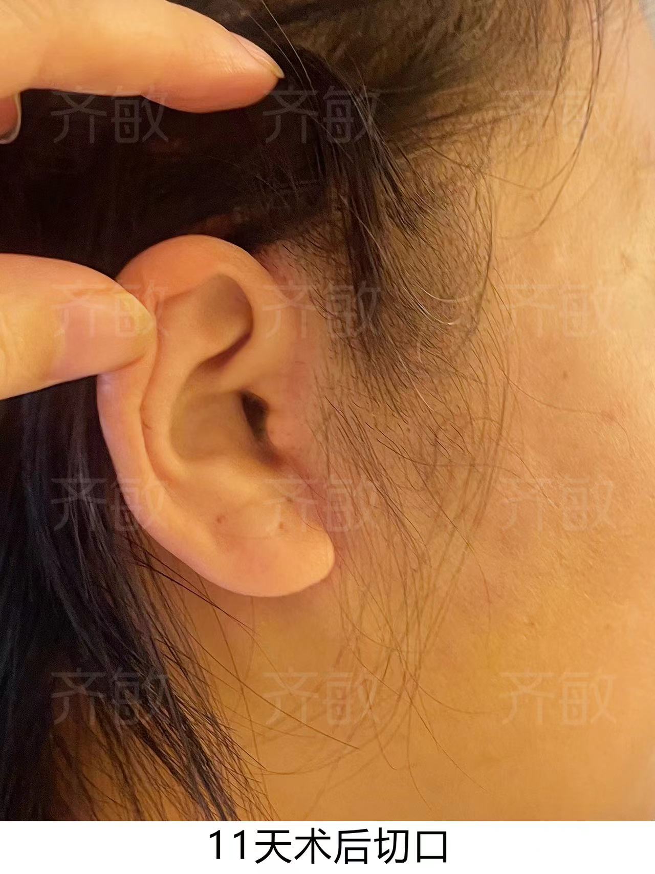 5. 上海九院整形科價(jià)目表中的“隱藏費(fèi)用”：哪些項(xiàng)目需要額外付費(fèi)？