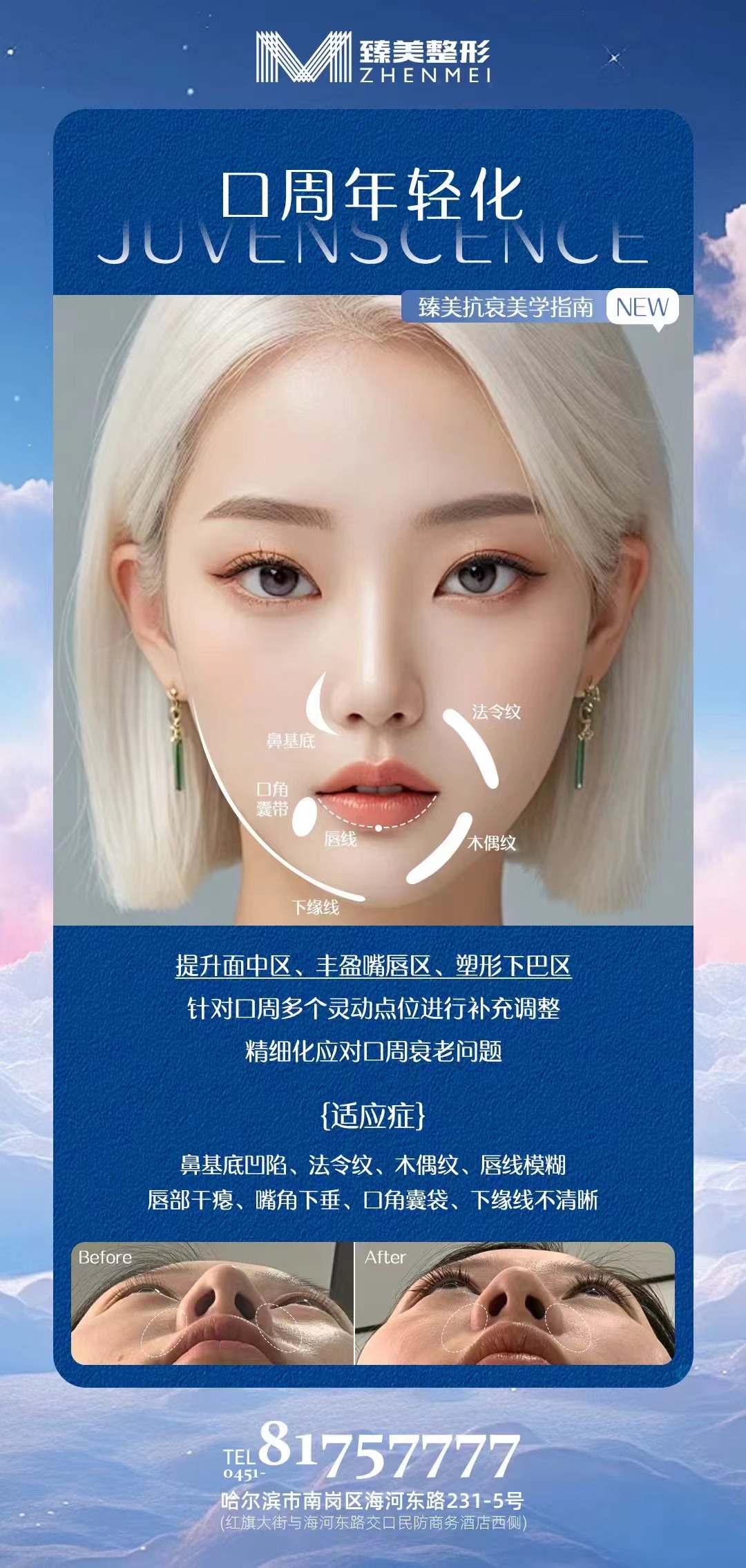 結(jié)合抗衰需求選擇超聲 刀m.66ub.cn