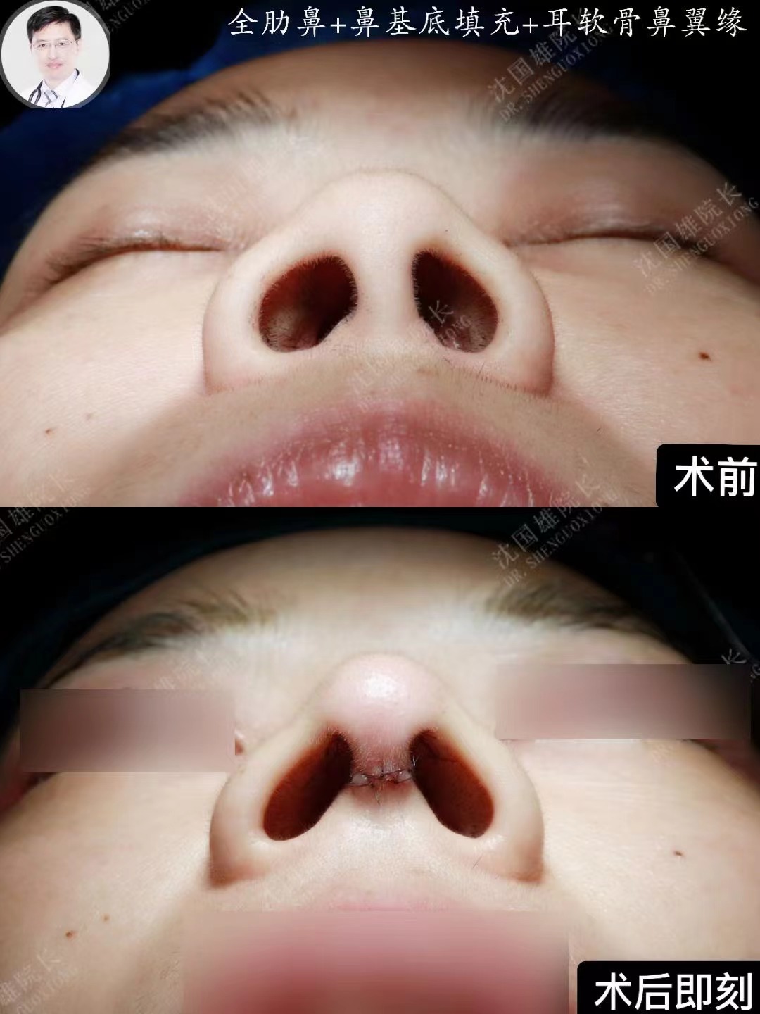 二、西安畫美張沙沙醫(yī)生核心技術(shù)優(yōu)勢(shì)