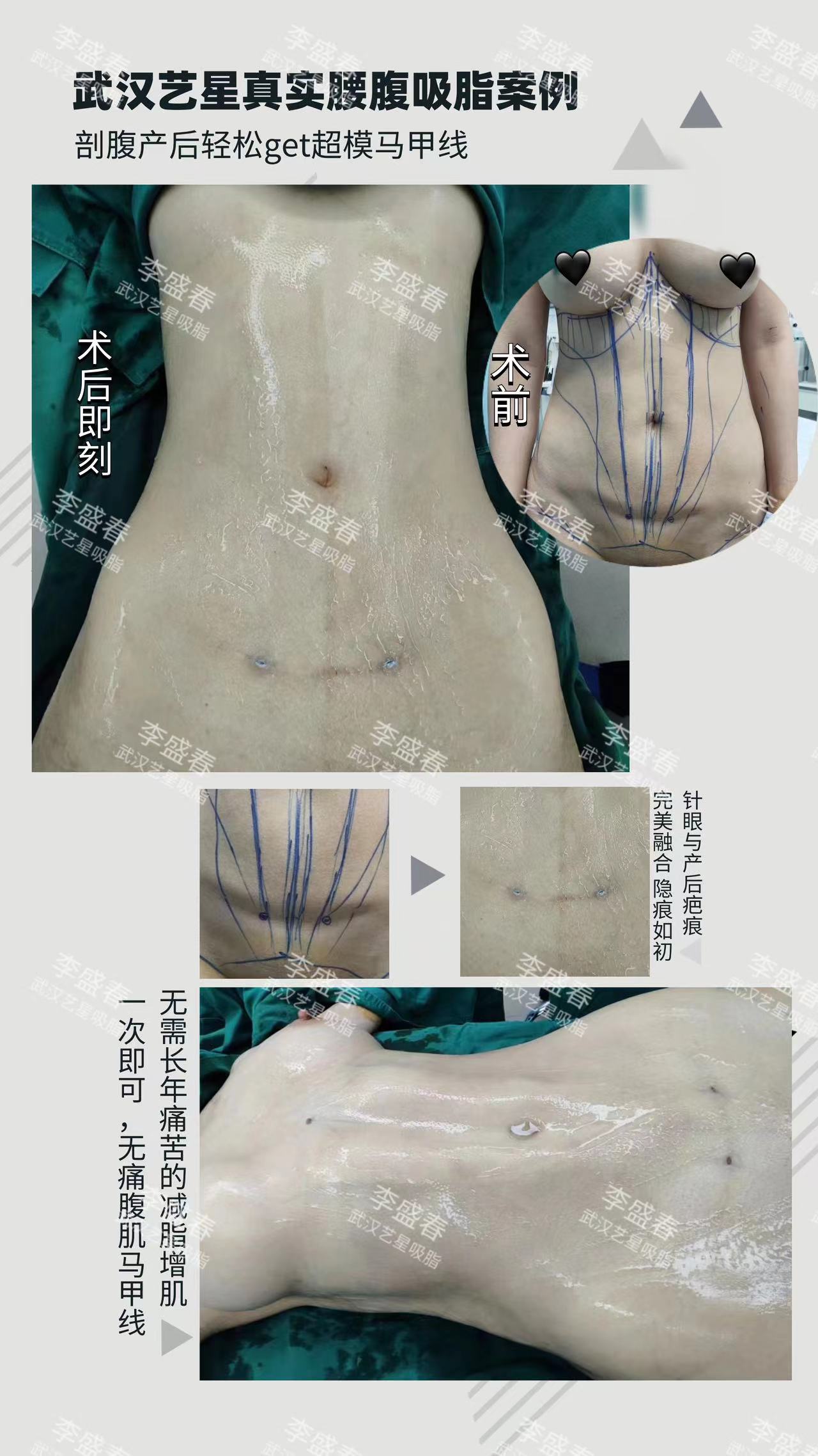 畫(huà)美張沙沙醫(yī)生預(yù)約方式