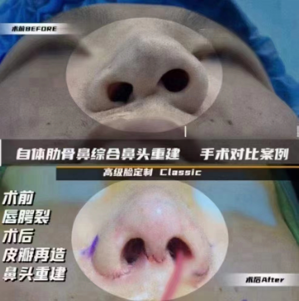 六、西安畫美張沙沙醫(yī)生預(yù)約方式與醫(yī)院環(huán)境