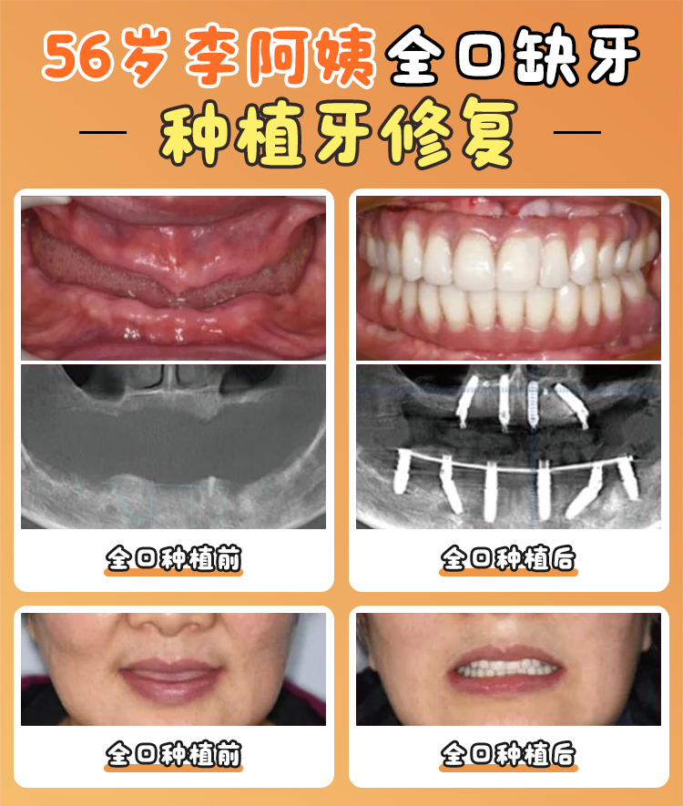 成都雙流牙科價(jià)格體系是否透明？