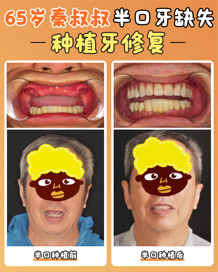 醫(yī)生團(tuán)隊：技術(shù)實力強(qiáng)，經(jīng)驗多