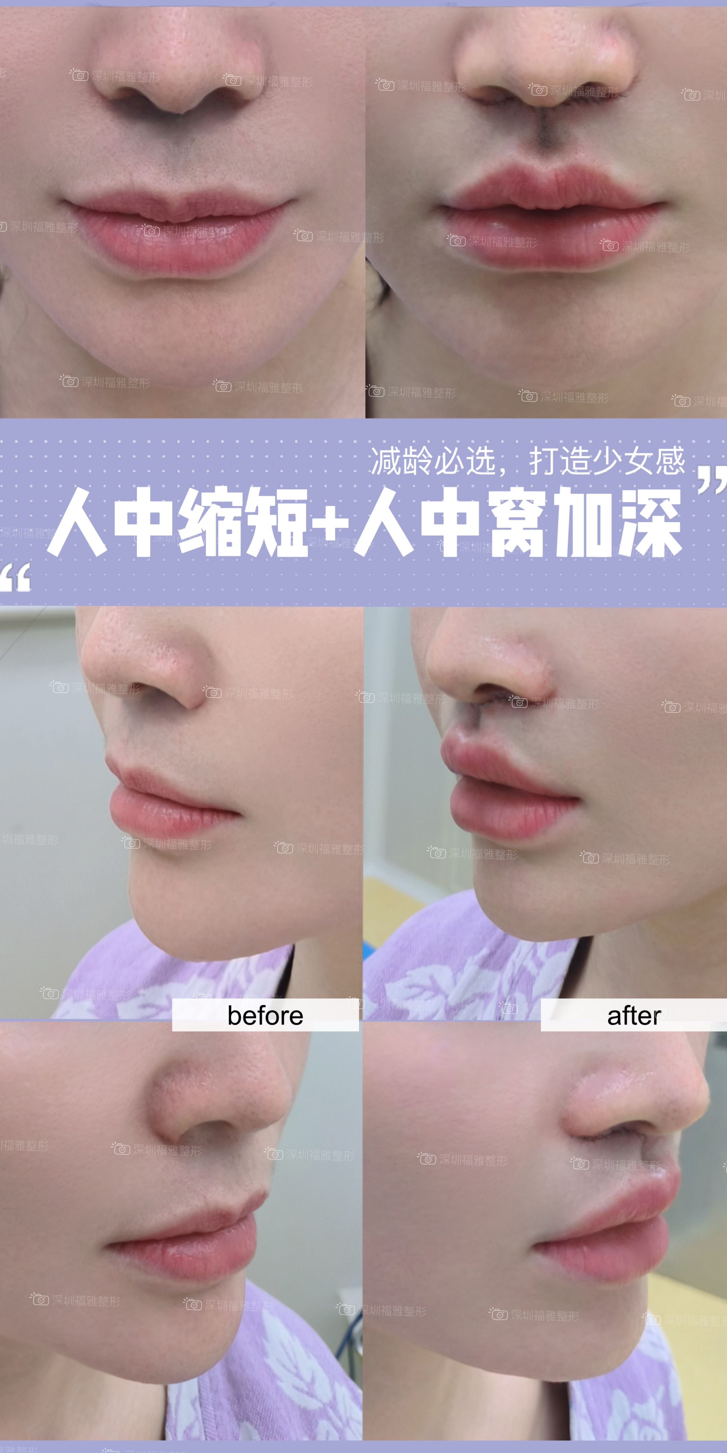 了解深圳碧莲盛植发其他信息