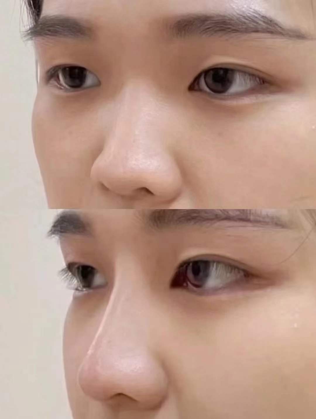 上海九院鼻整形专家排名，戴传昌、李圣利等大咖上榜，技术口碑双优值得信赖！ 