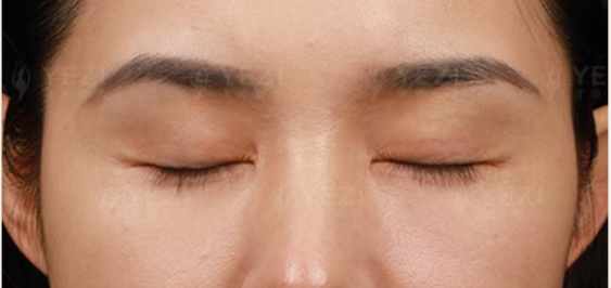 管皓楠醫(yī)生：精細(xì)化修復(fù)的“細(xì)節(jié)控”