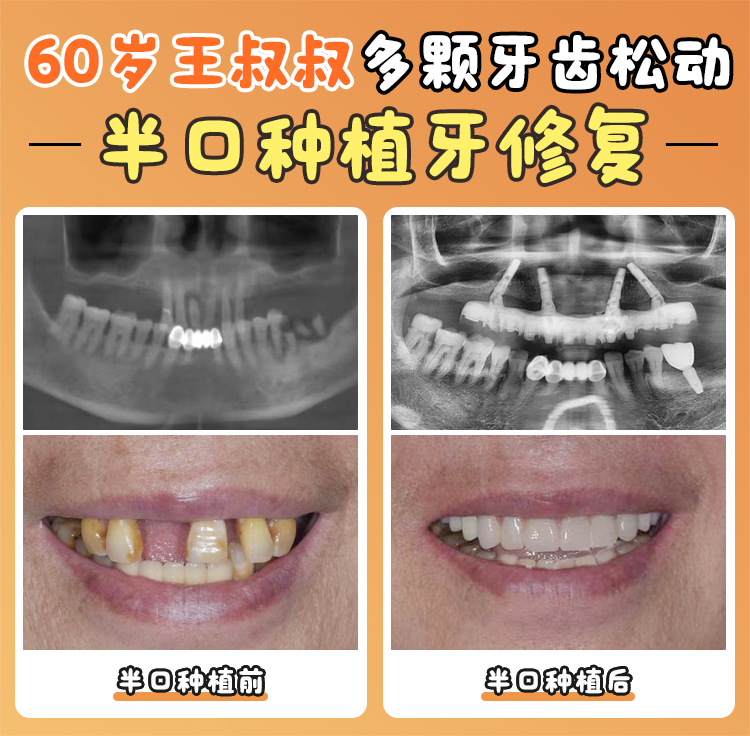 焦作植得口腔醫(yī)院口碑評價