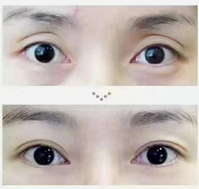 五、北京私密整形避坑指南