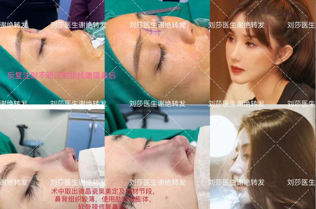 六、北京私密整形项目价格参考