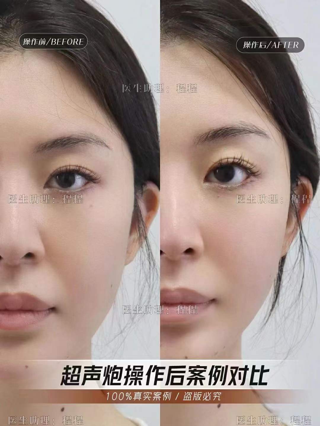 蔡圣民醫(yī)生的不錯技術體現(xiàn)在哪些方面？