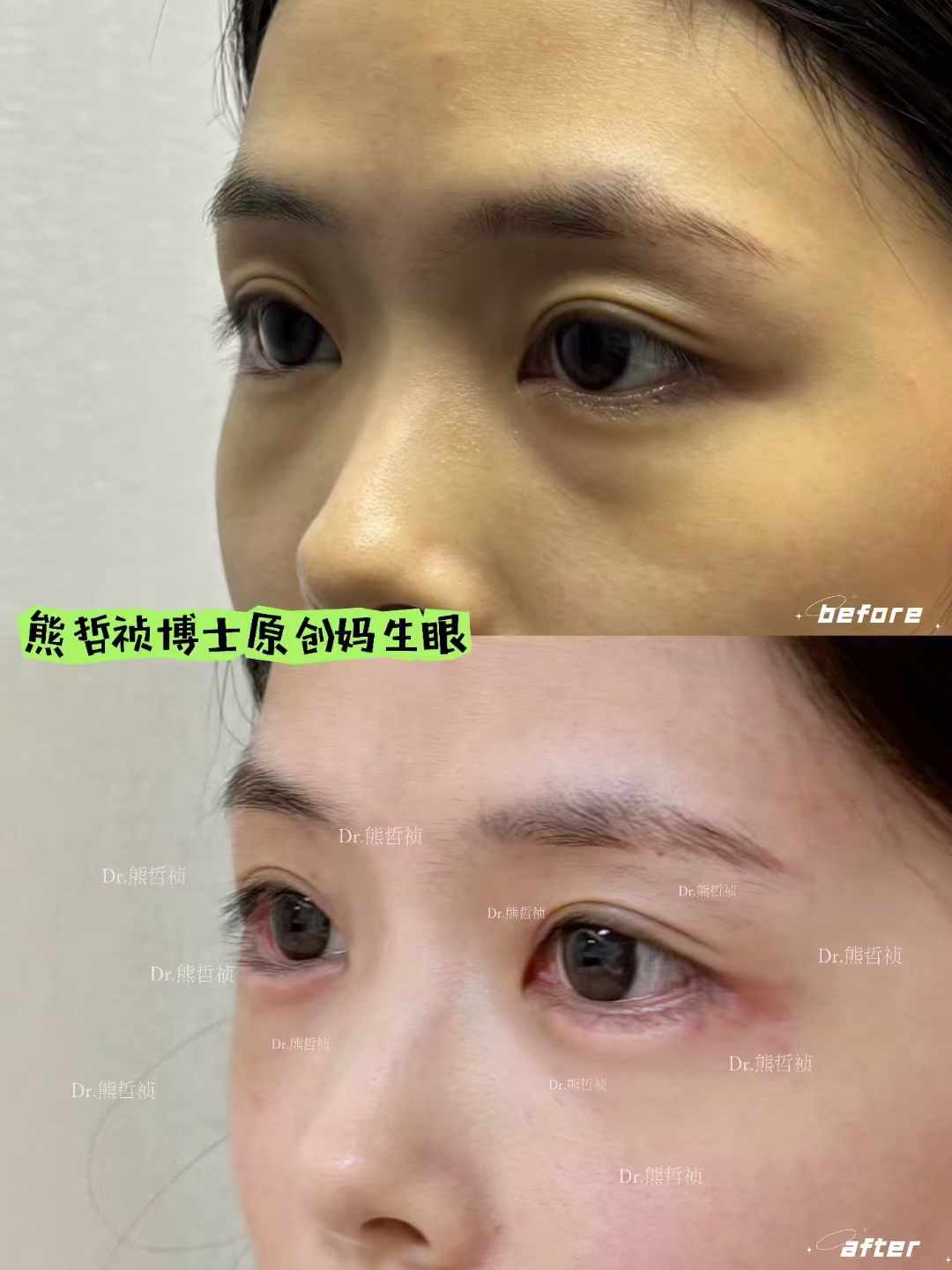 杭州浙江二院眼科骨干醫(yī)生門診掛號：多種方式任你選