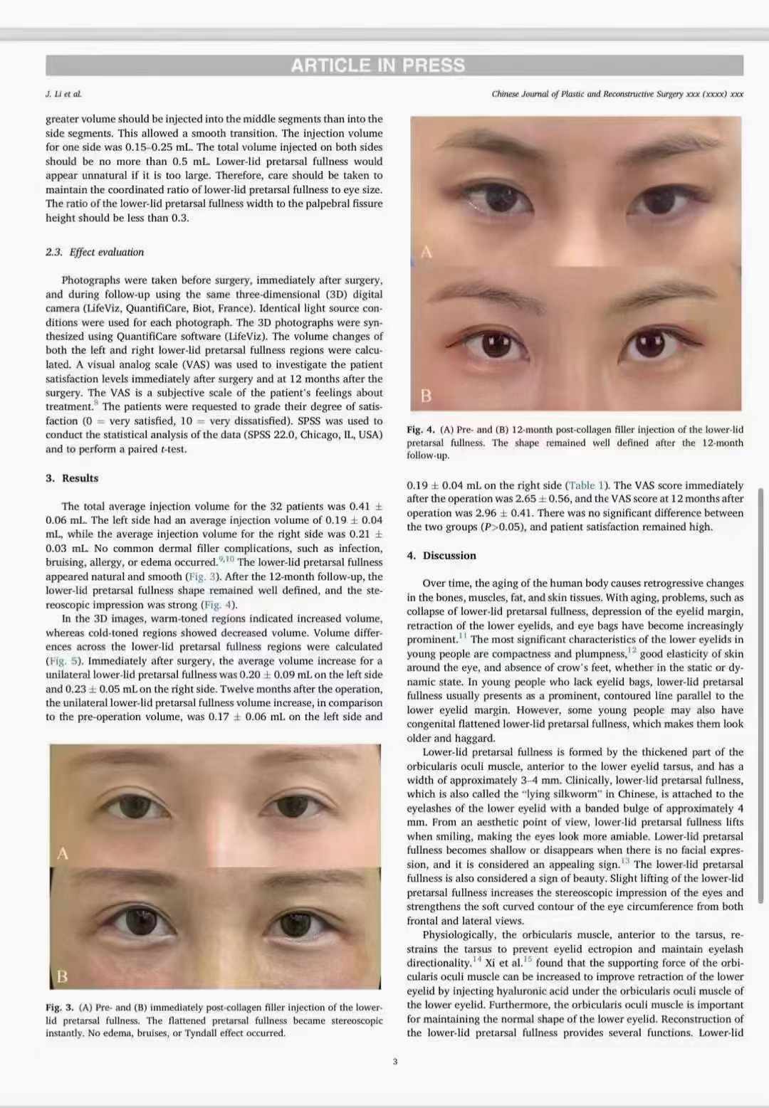 杭州浙江二院眼科骨干醫(yī)生門診預約：提前規(guī)劃更省心