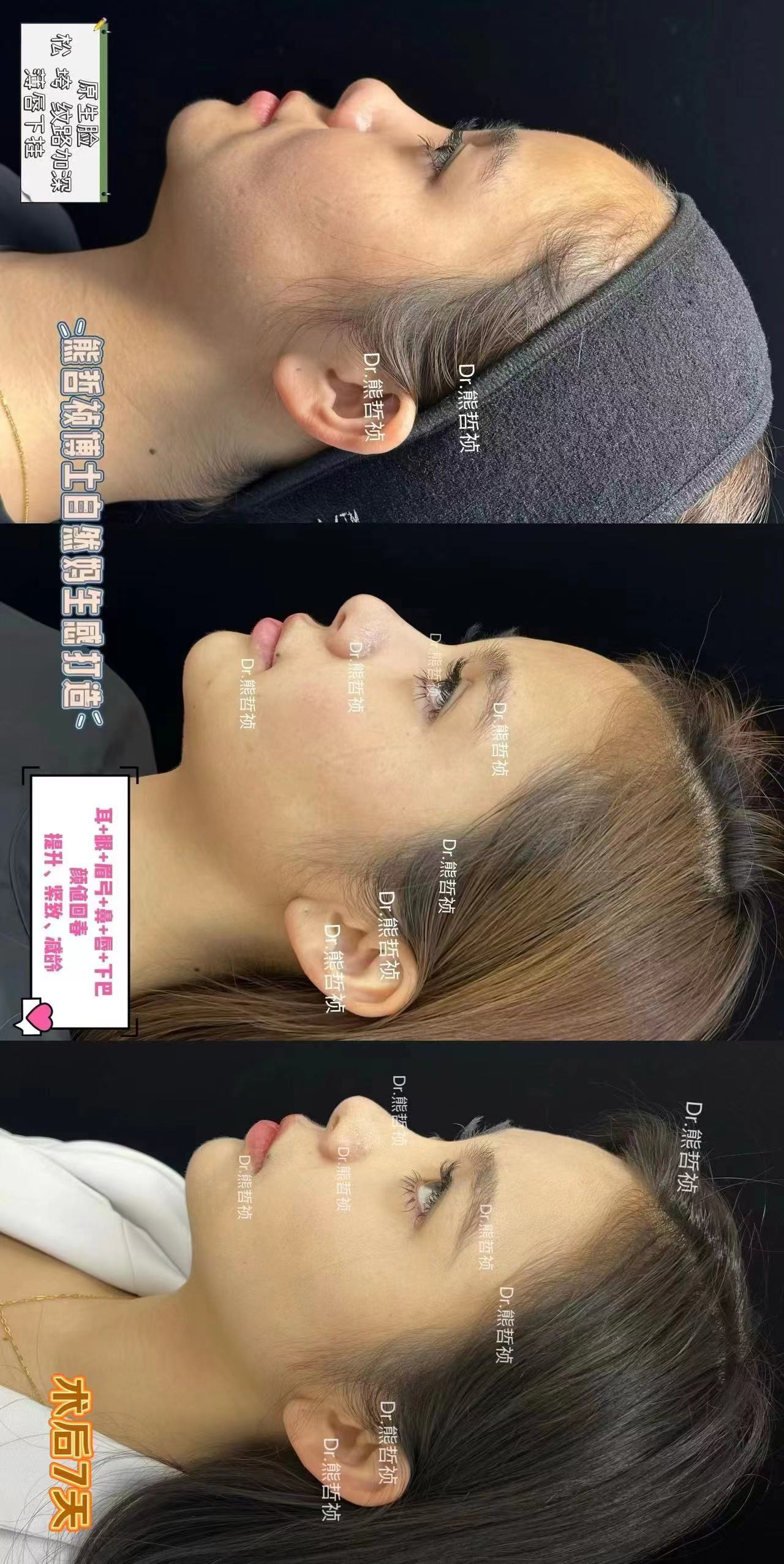 杭州浙江二院眼科骨干醫(yī)生門診地址及交通：輕松到達