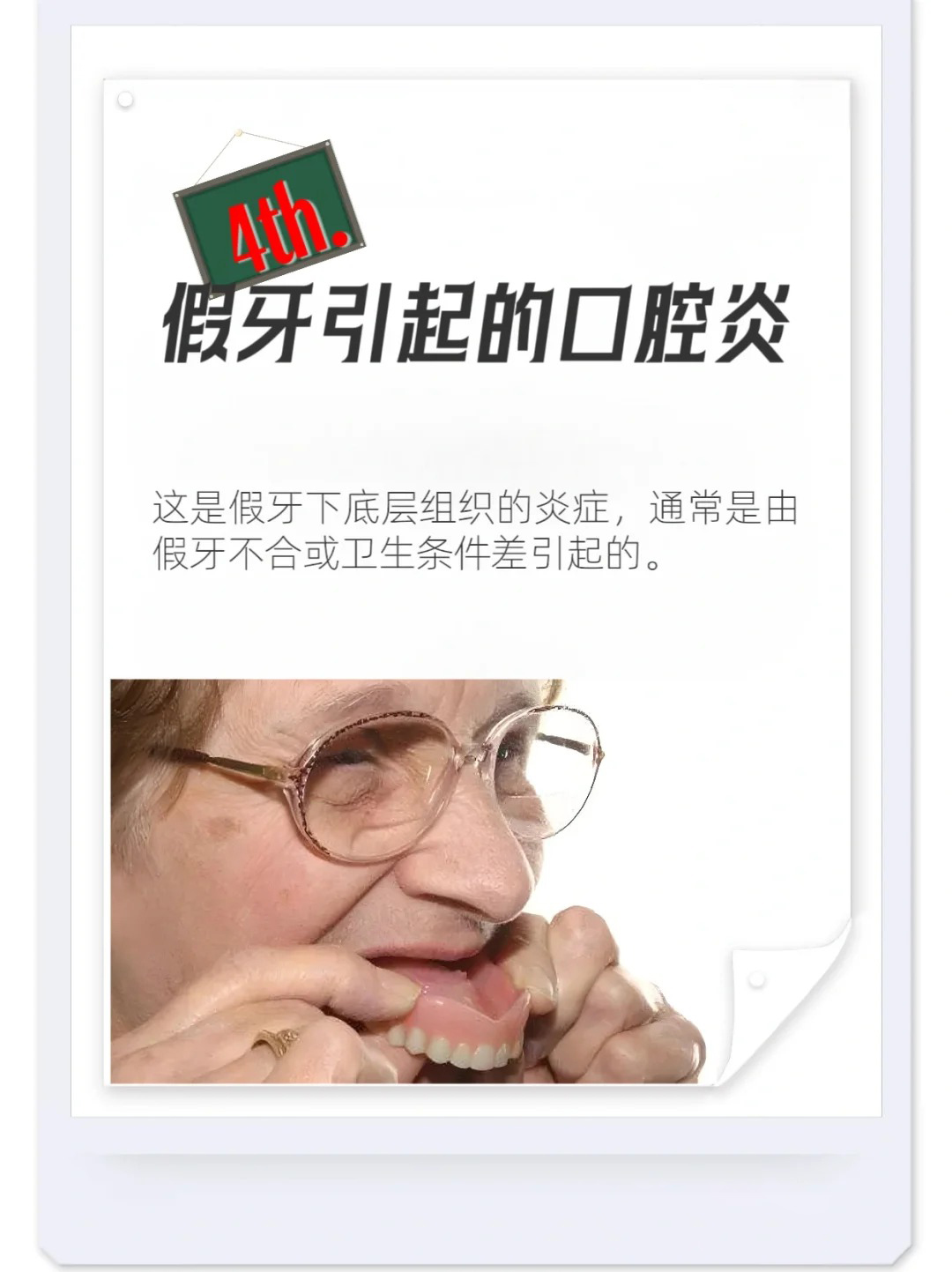 泰康拜博口腔真實成效