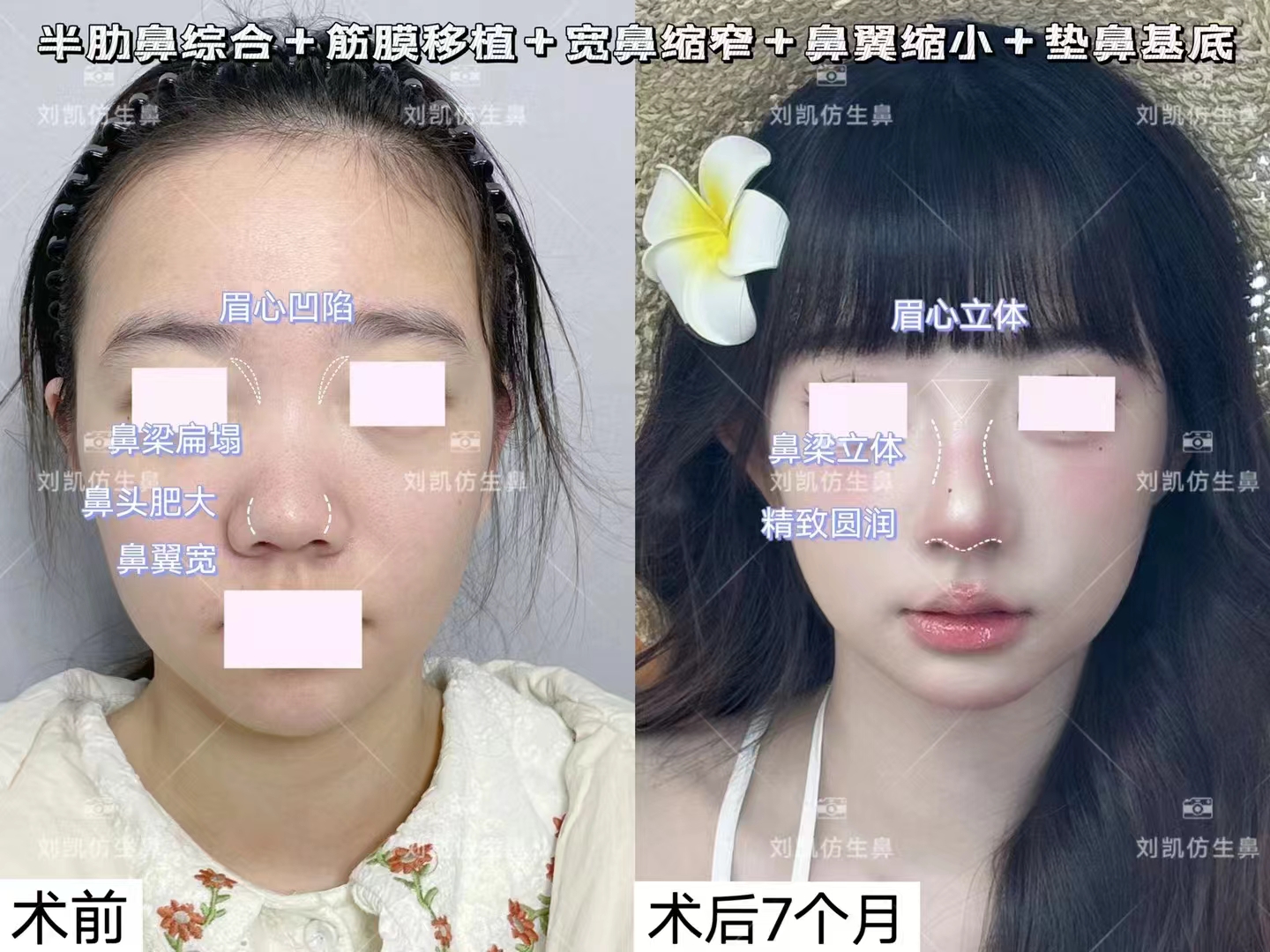 上海九院拉皮還有哪些靠譜骨干醫(yī)生可選？