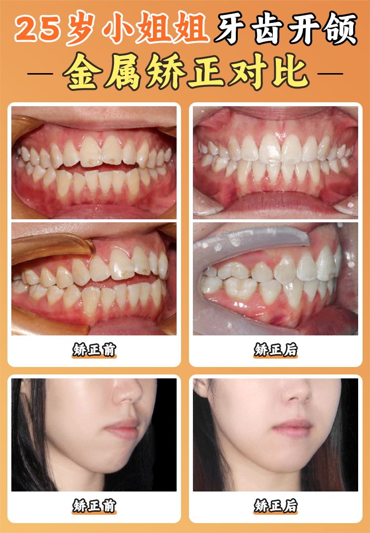 泰康拜博口腔地址電話預約攻略