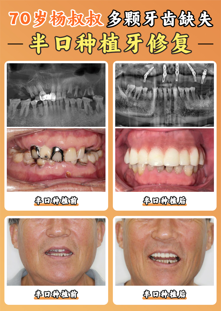 江苏泰康拜博口腔门店之旅