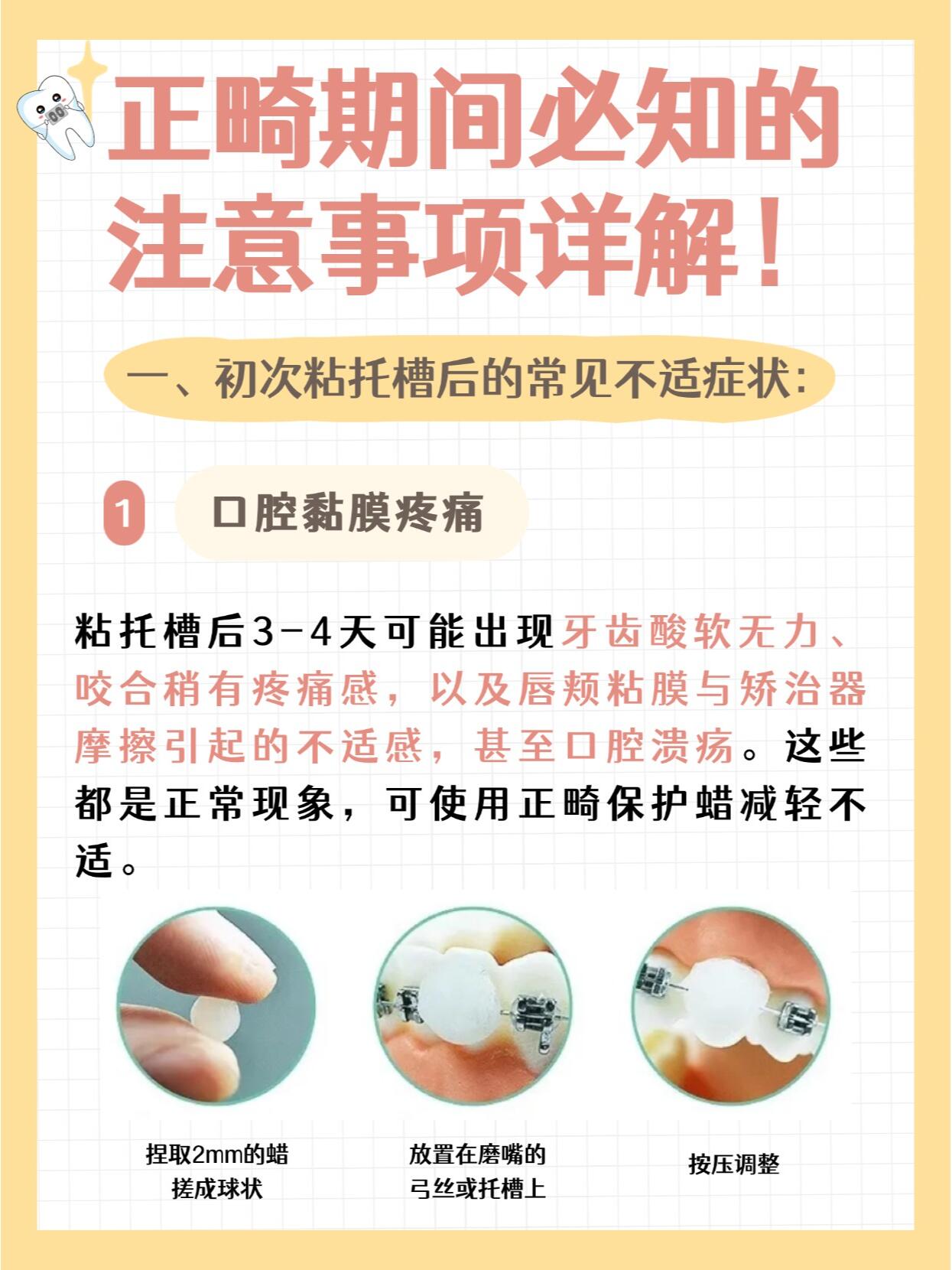 避坑要點(diǎn)：了解細(xì)節(jié)，放心就診