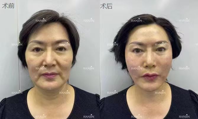 上海九院拉皮掛什么科？怎么掛號(hào)？