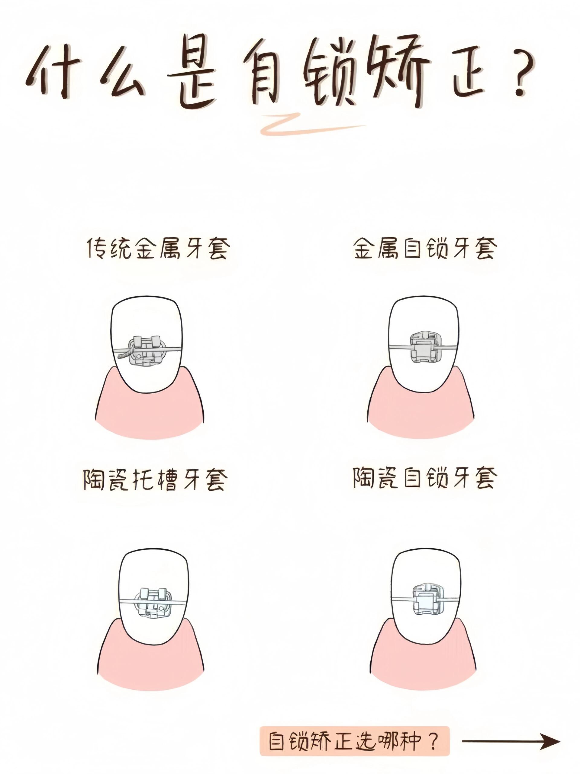 避坑要点需知晓