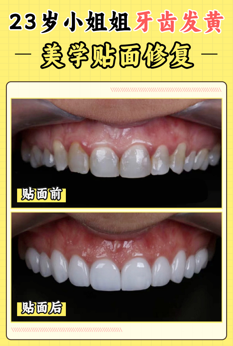 諾貝爾國內(nèi)連鎖口腔醫(yī)院有哪些