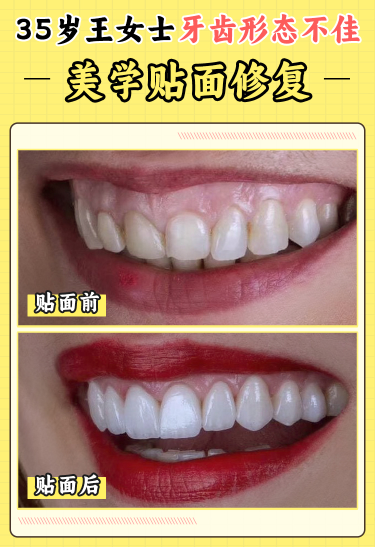 西安諾貝爾口腔醫(yī)院