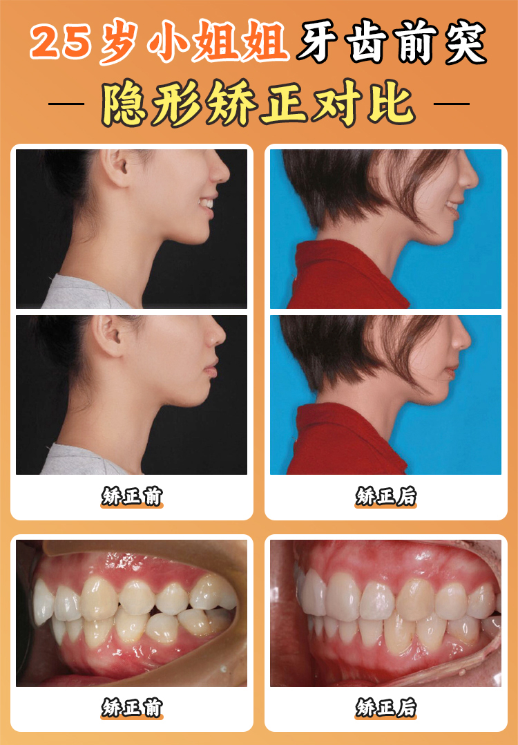 諾貝爾口腔醫(yī)院的技術(shù)實(shí)力