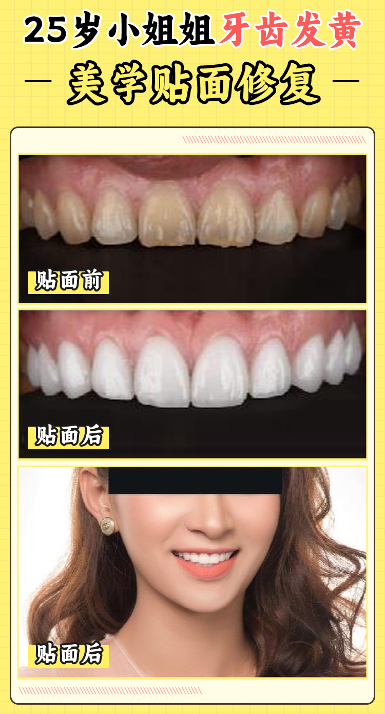 焦作植得口腔醫(yī)院口碑評(píng)價(jià)——患者的真實(shí)反饋