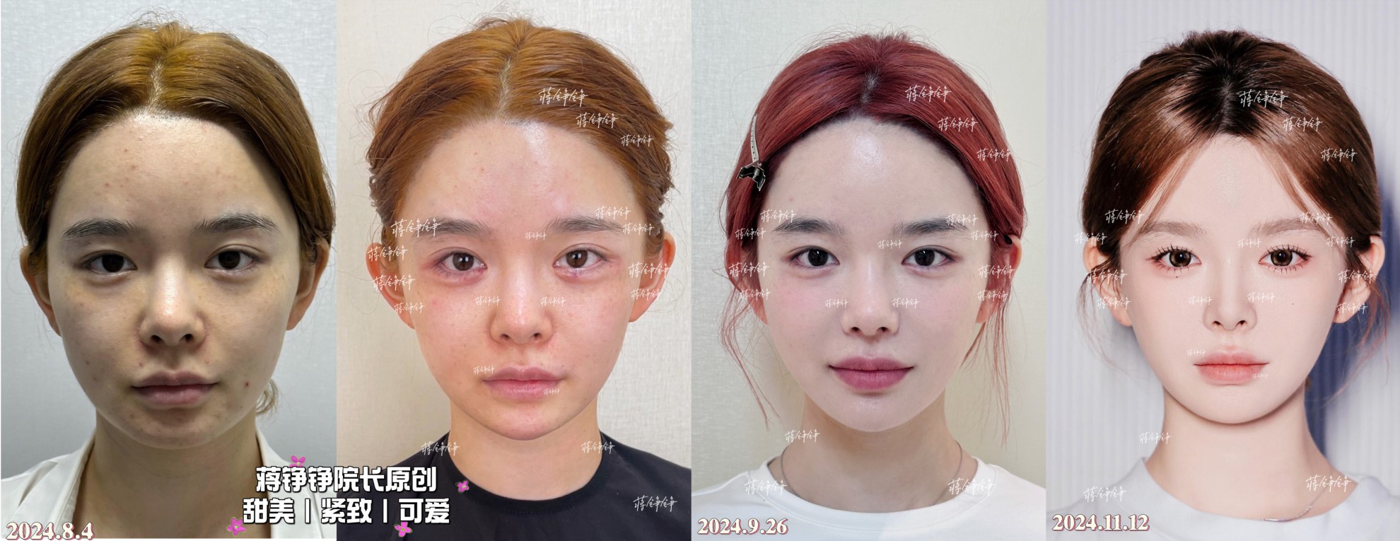 上海九院鼻子注射物取出更好的医生是谁？这几位骨干医生闭眼选