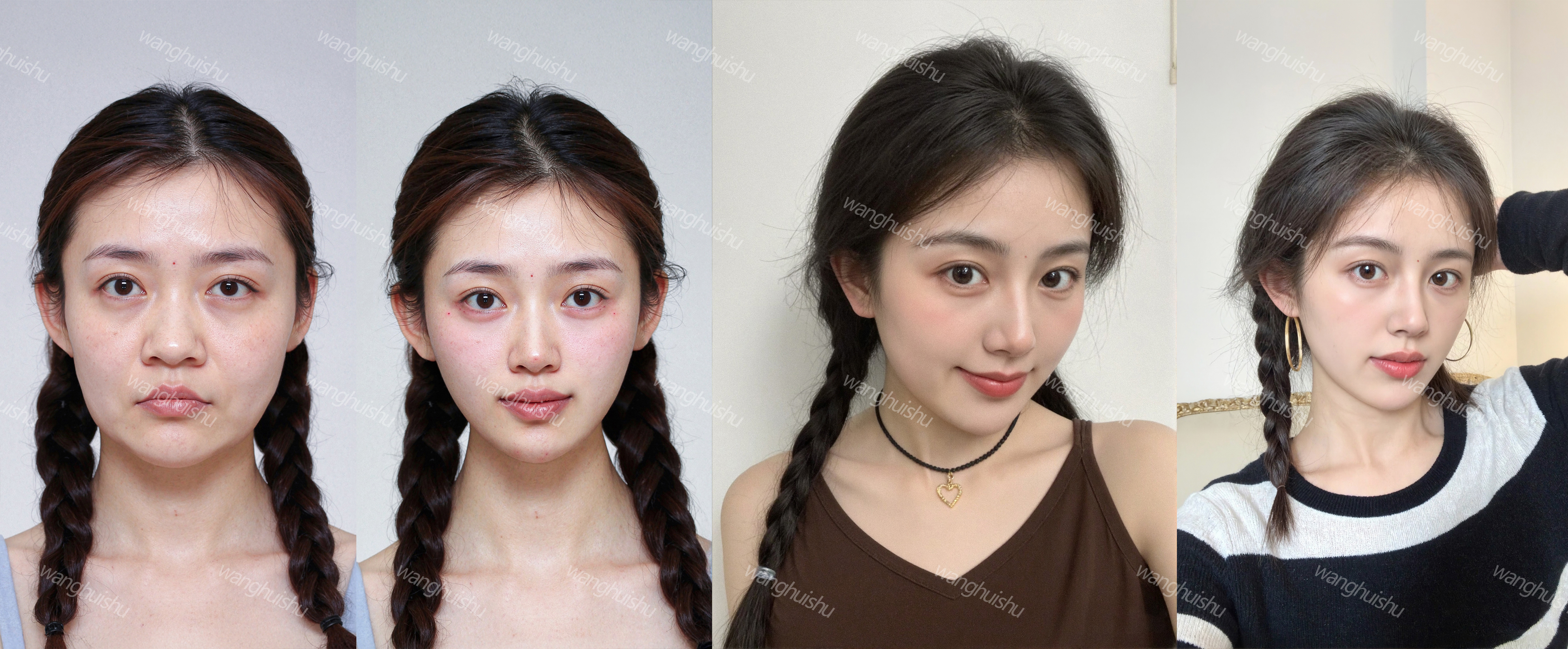 成都友華普惠眼科醫(yī)院的暑期補(bǔ)貼