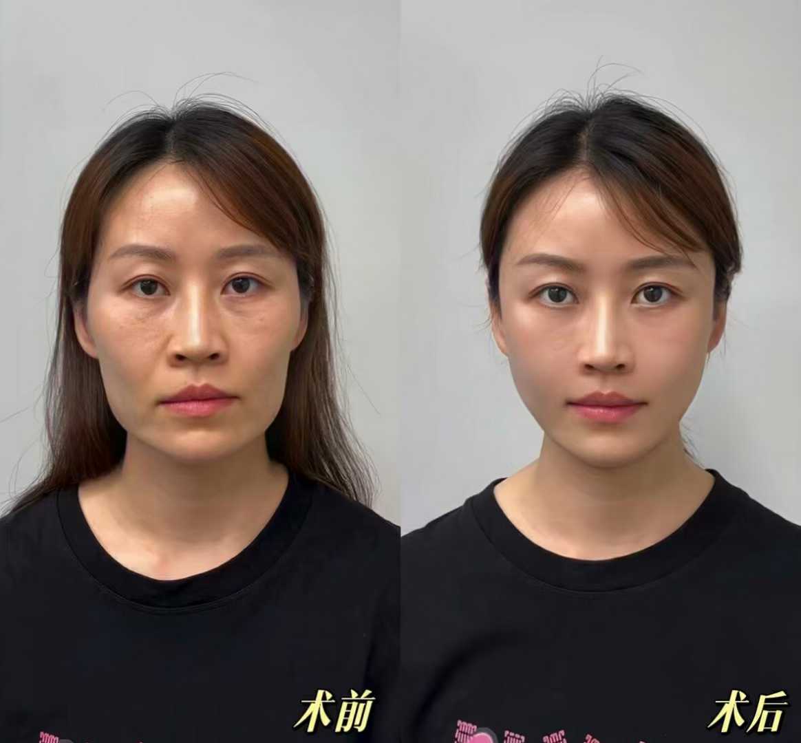 友華普惠眼科與愛爾眼科的對(duì)比