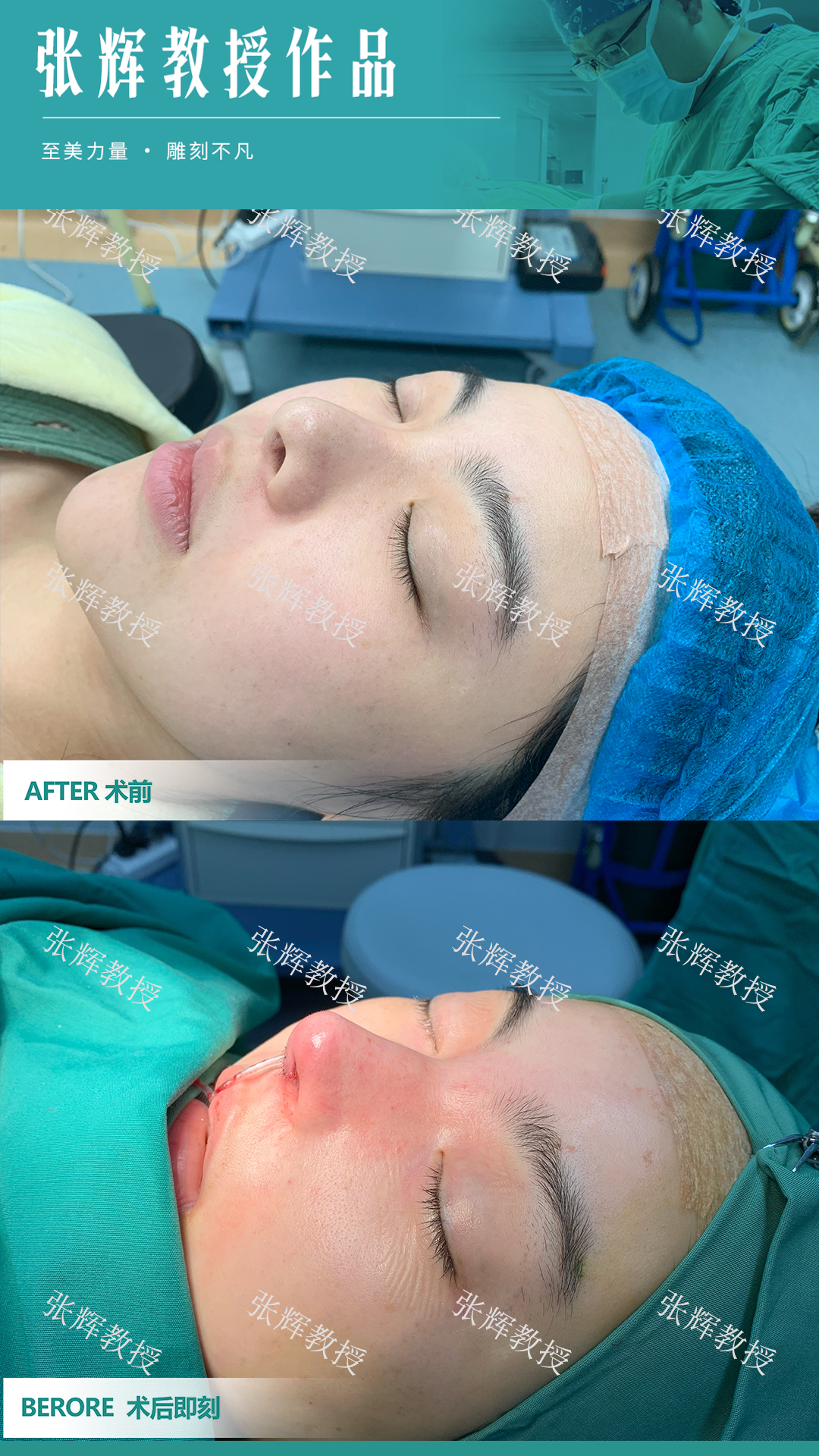 上海九院鼻子注射物取出避坑指南：这些套路千万别踩