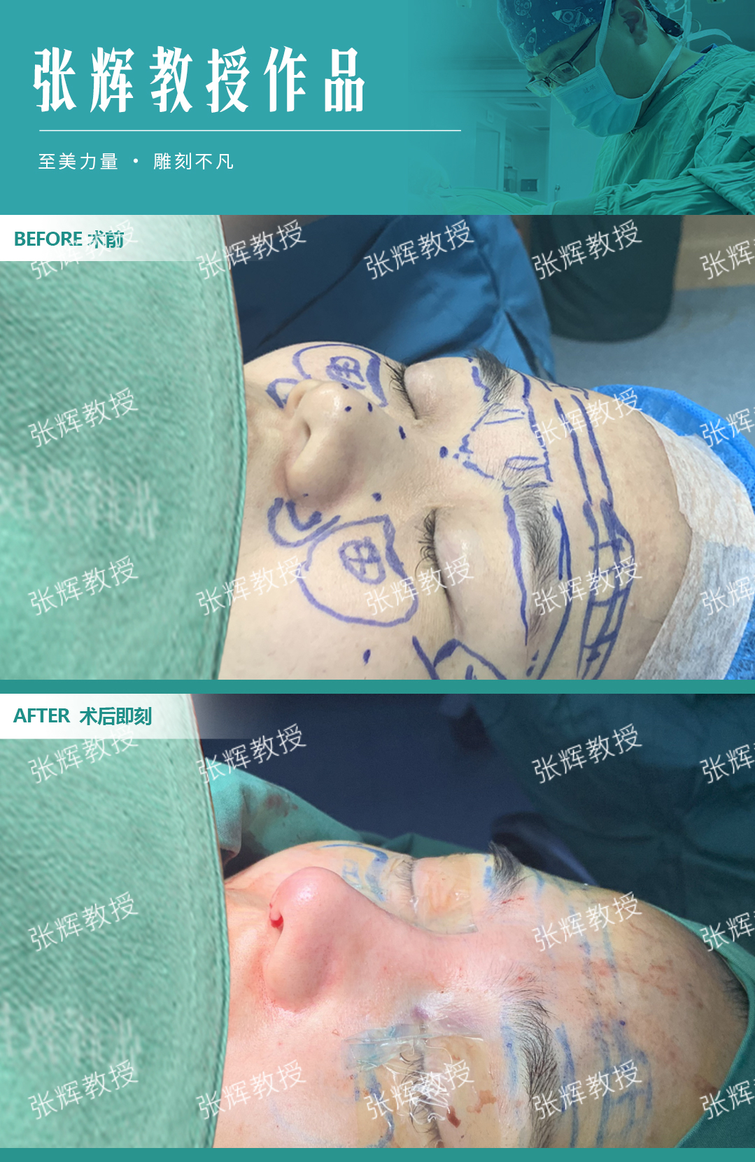 上海九院鼻子注射物取出预约攻略：一步到位不跑空