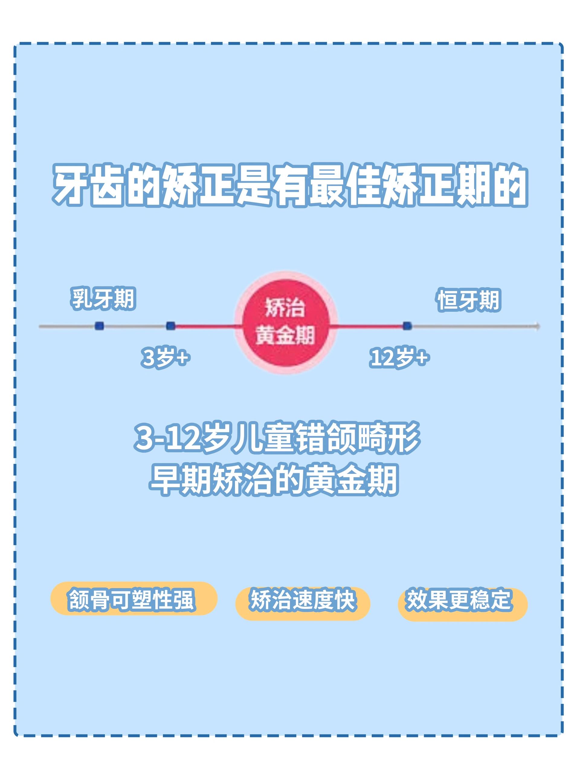 諾貝爾口腔適合哪些人群