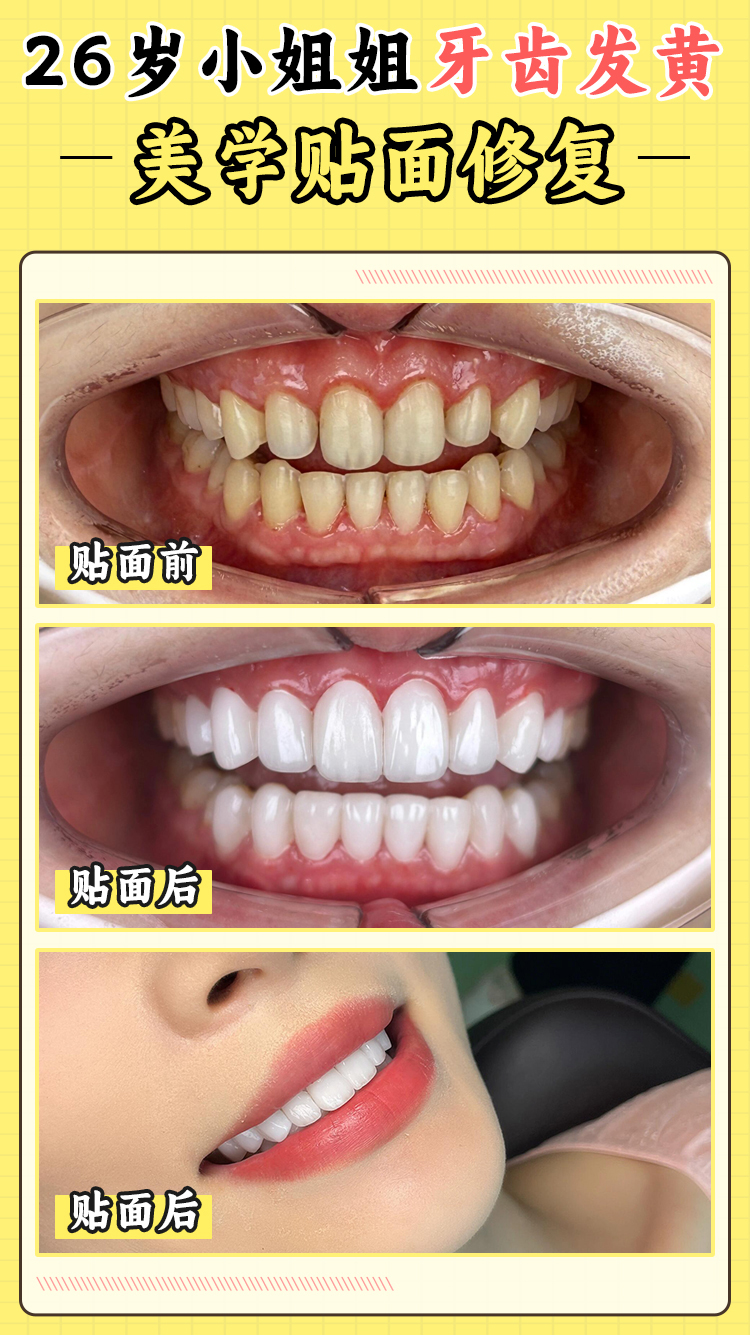 確認(rèn)自身需求