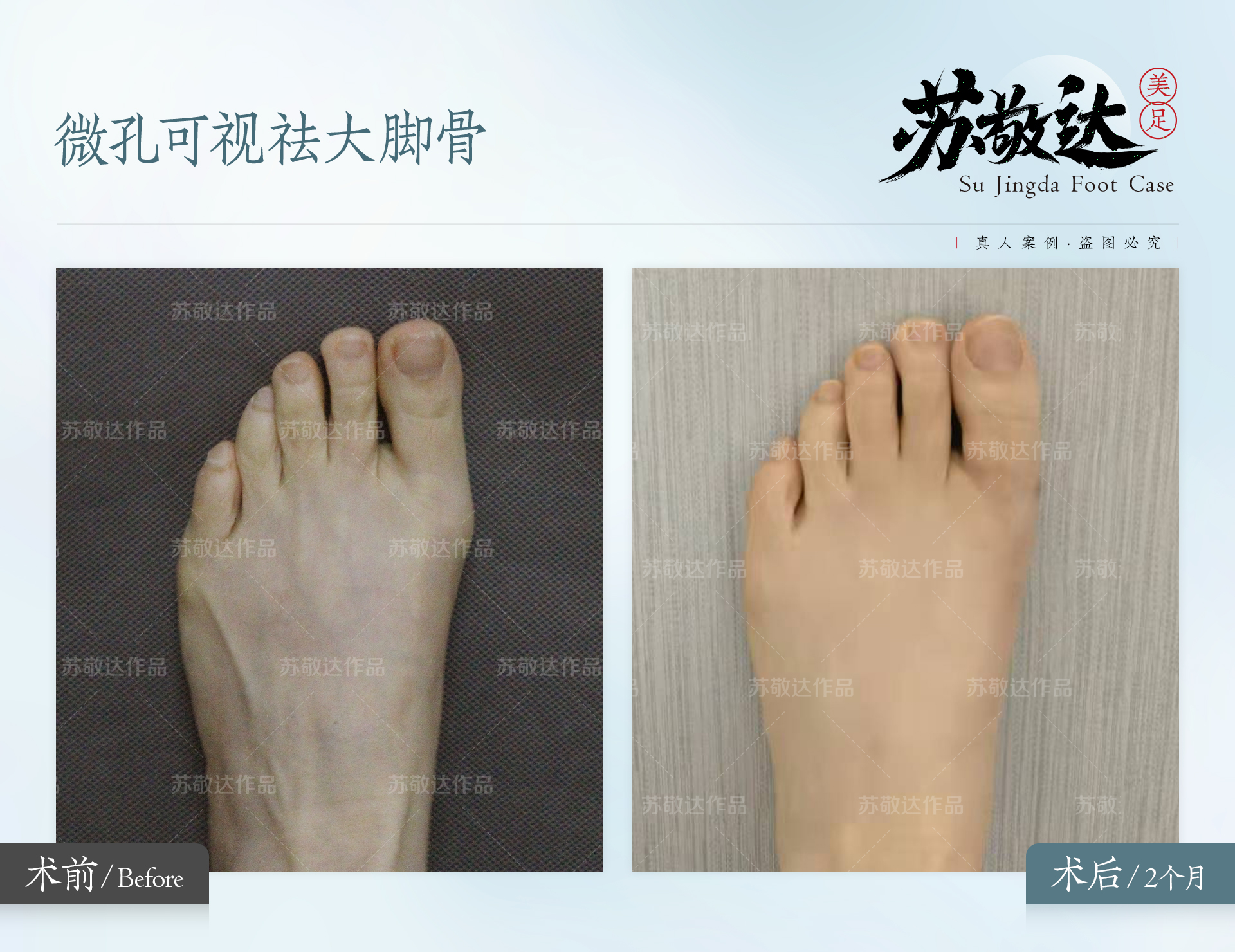 北京華廈民眾眼科醫(yī)院怎么樣?收費(fèi)標(biāo)準(zhǔn)