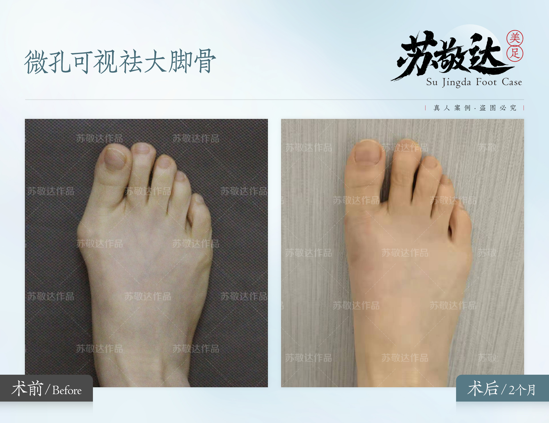 北京華夏民眾眼科醫(yī)院口碑——真實實例見證成效