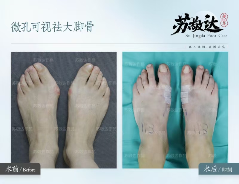 北京華廈民眾醫(yī)院眼科怎么樣——適合人群廣泛