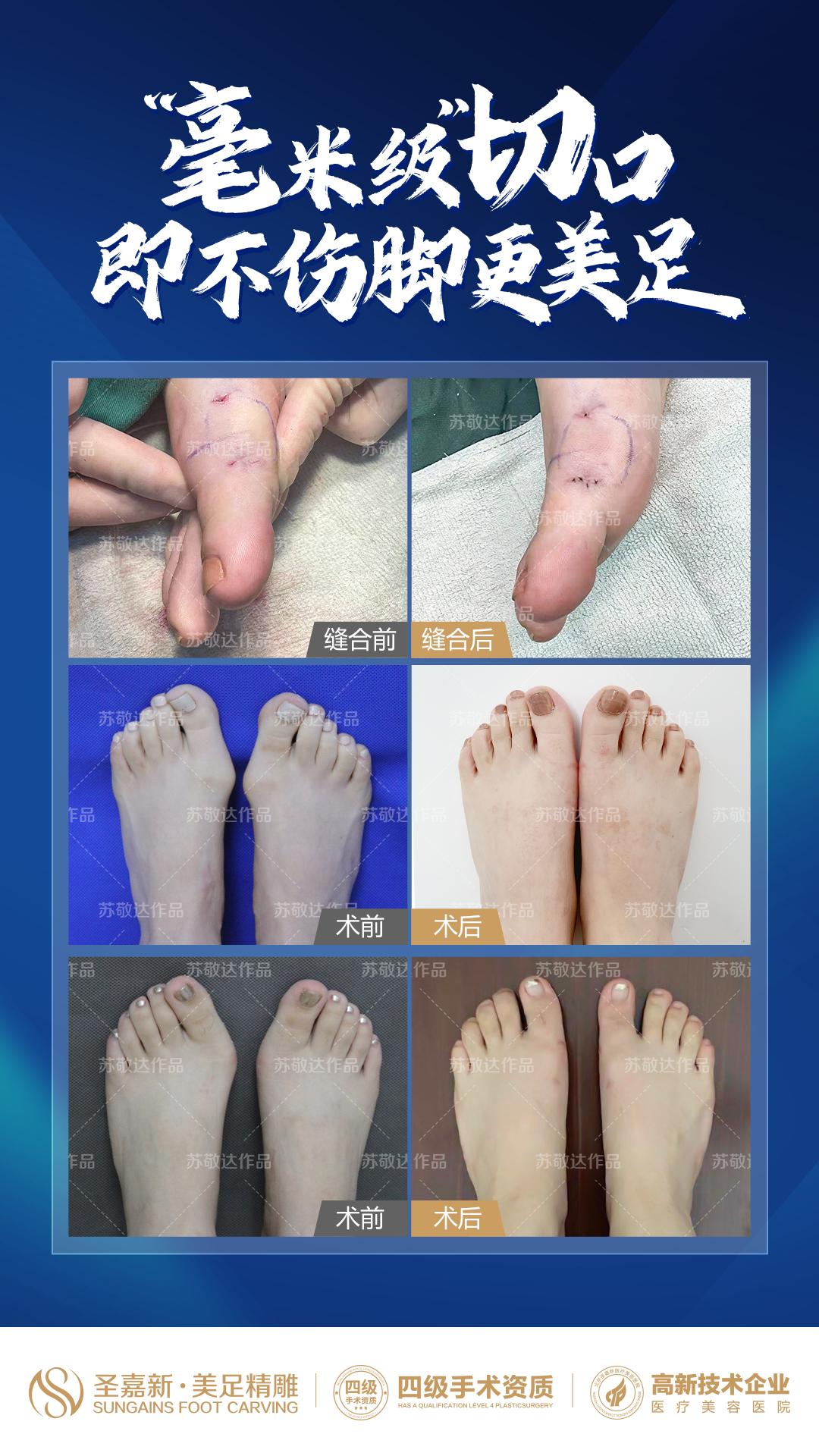 北京華廈民眾眼科醫(yī)院怎么樣——地址電話預(yù)約攻略