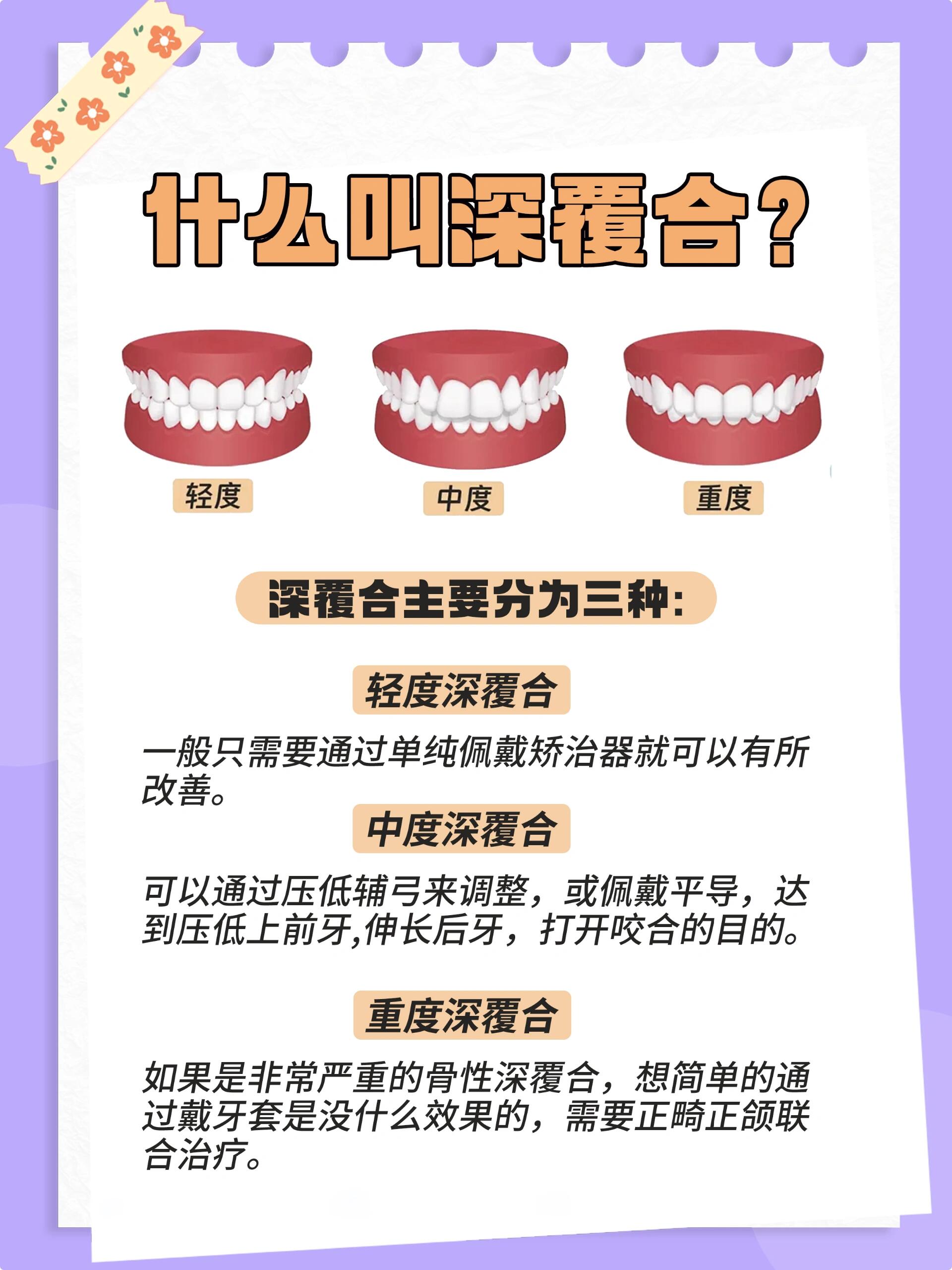 植雅口腔的收費(fèi)合理性分析