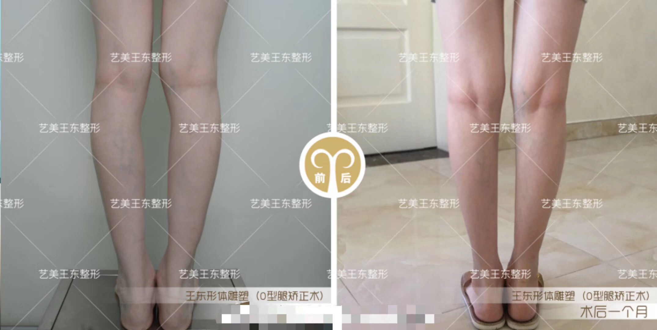 如何選擇適合自己的眼科醫(yī)院