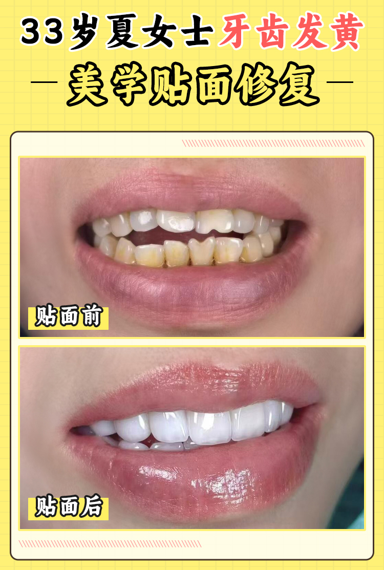 東臺(tái)固德熊貓口腔是私人的嗎？是的，它是私立口腔機(jī)構(gòu)，服務(wù)貼心技術(shù)優(yōu)！ 