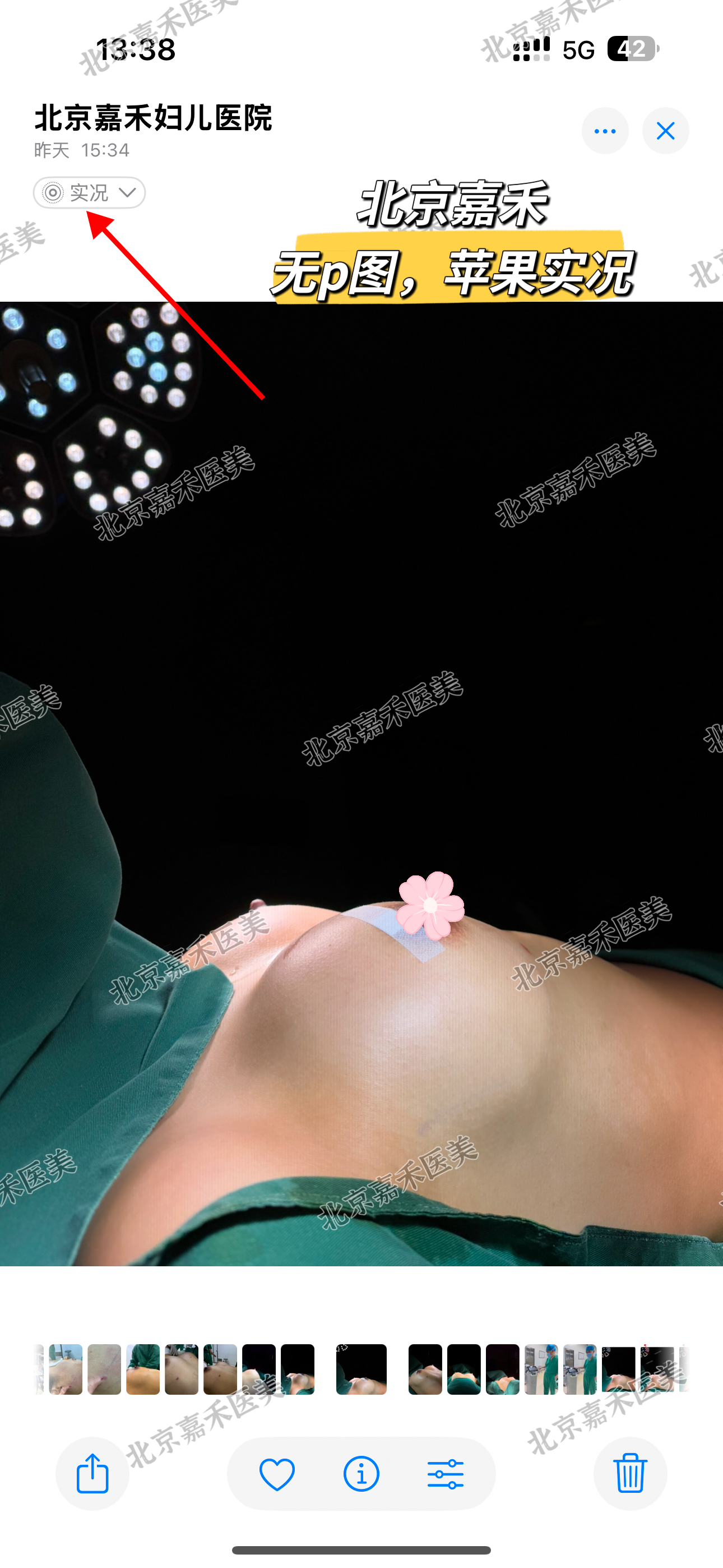 上海九院隆胸醫(yī)生排名榜：董佳生“棉花糖豐胸”為何受青睞？