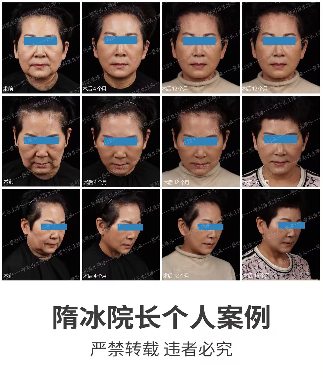 北京嘉禾其他美容項目價格如何？