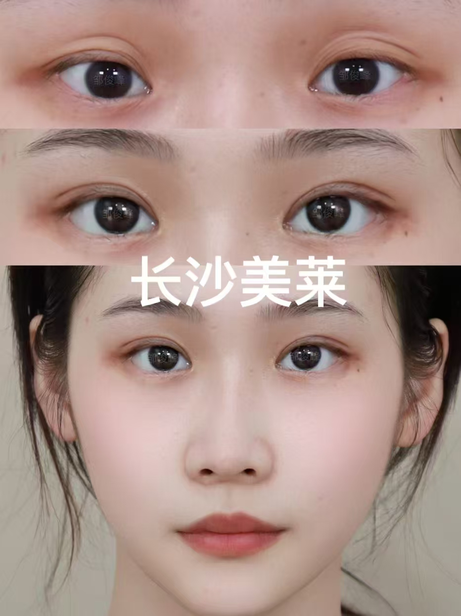 王鹤:泪道疾病治疗骨干医生