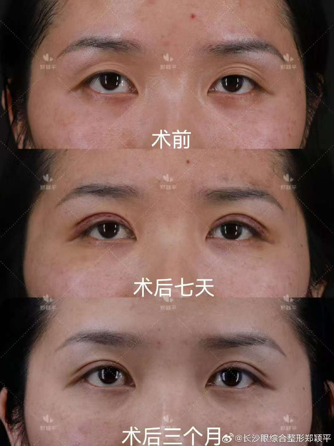 刘艳丽:经验多的综合眼科医生