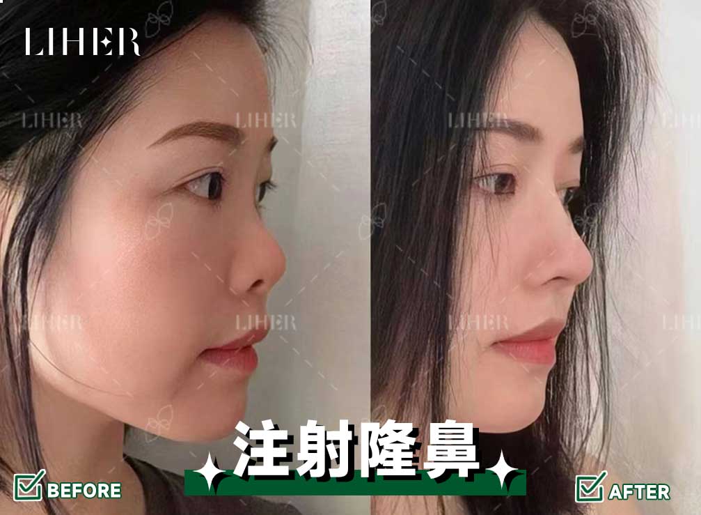 隆鼻等熱門項目技術(shù)領(lǐng)跑