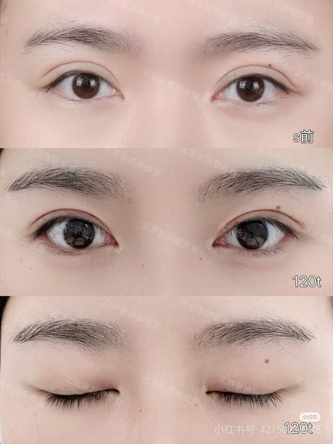 北京美爾目第二眼科醫(yī)院骨干醫(yī)生出診預約方式全攻略