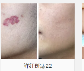 壹加壹醫(yī)療美容醫(yī)院是正規(guī)連鎖，13家分院全持證+隆鼻13800元起，醫(yī)生團隊曝光！